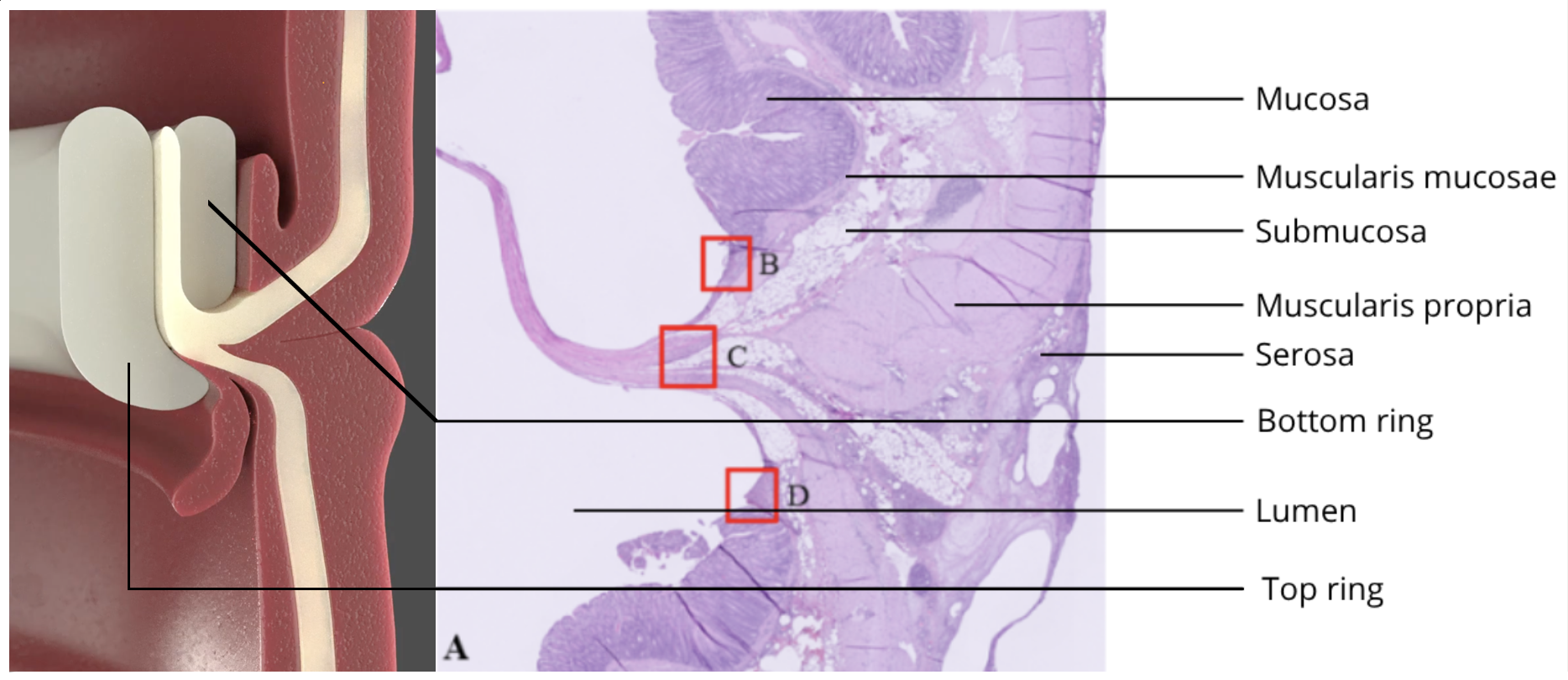 Preclinical composite showing the Implican compression rings and histological tissue interface