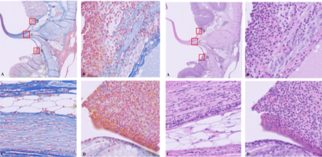 Histology micrograph from postoperative day one