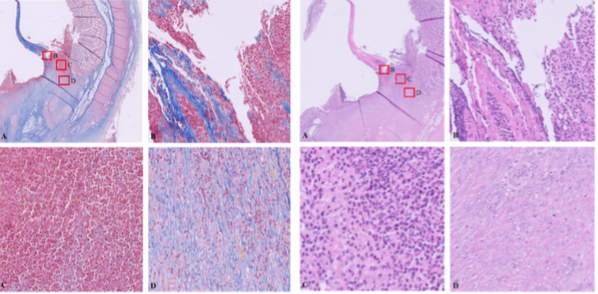 Histology micrograph from postoperative day seven